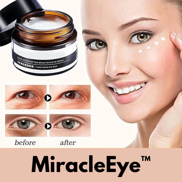 1+1 GRATIS | MiracleEye™ | Faltenradierer Straffende Augencreme [Letzter Tag Rabatt]