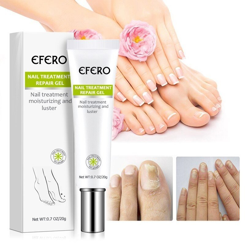 Nail Repair™ -  Schnelle und effektive Ergebnisse! [Letzter Tag Rabatt]